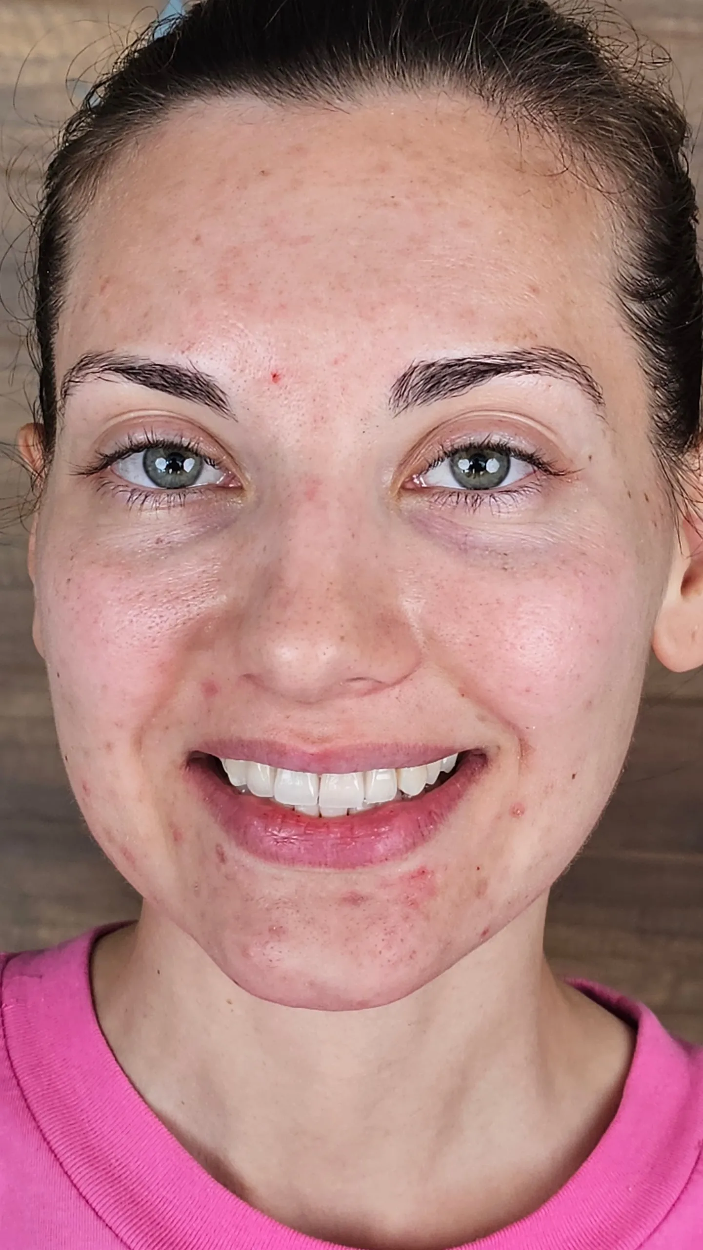Anna Stringer — Before & After