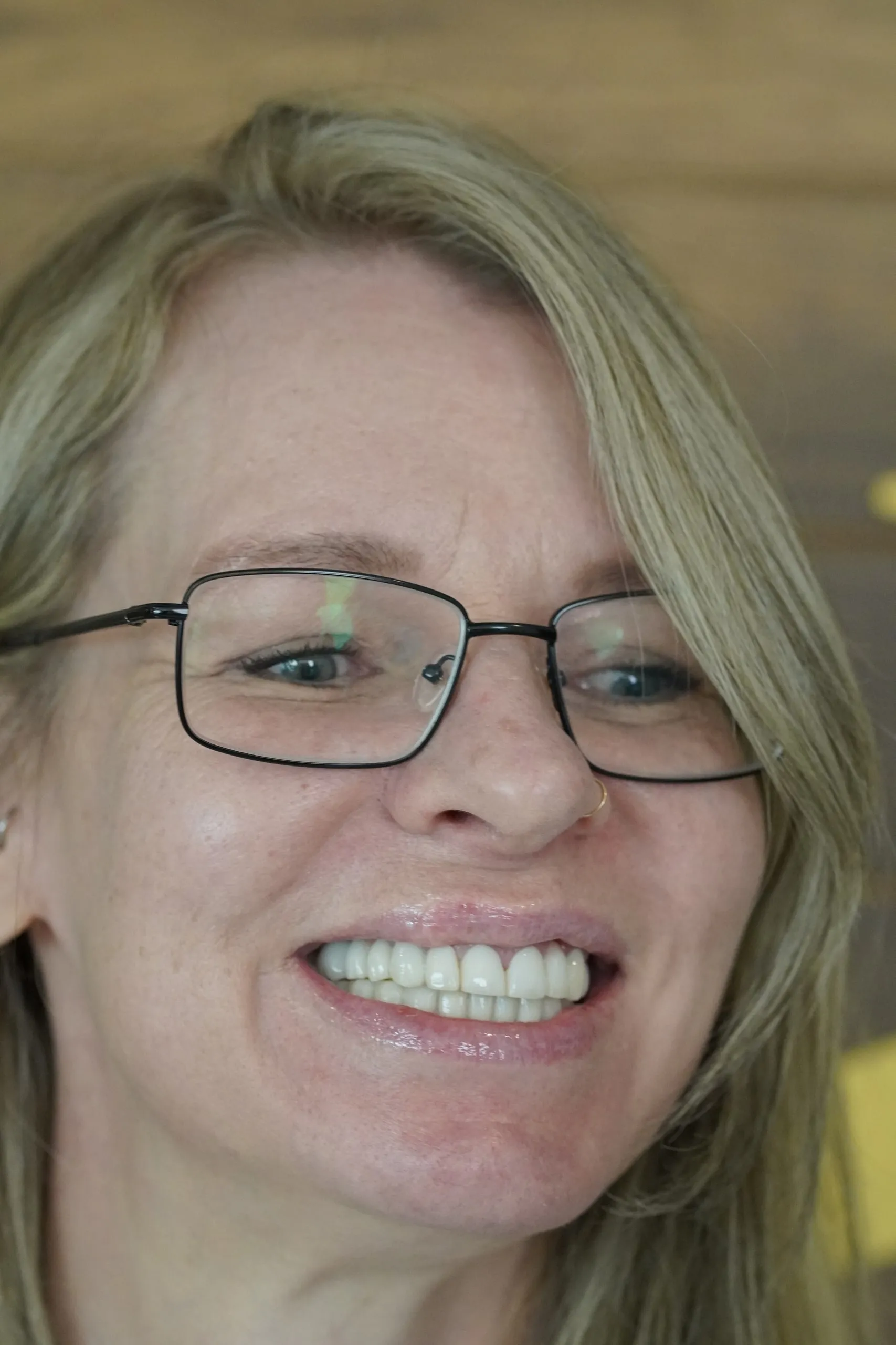 Digital Smile Design