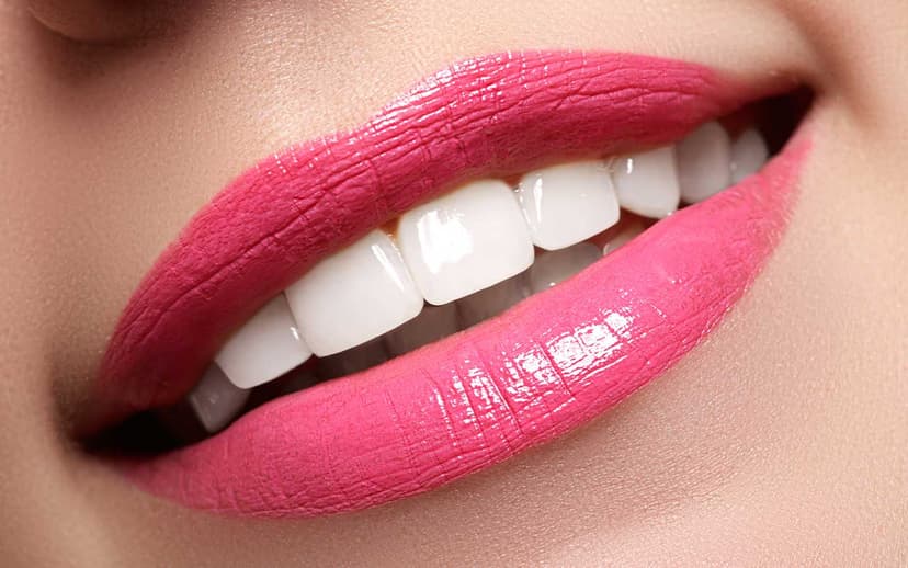 Hollywood Smile treatment 1