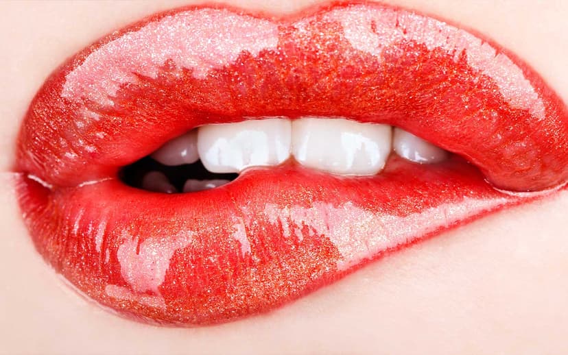 Hollywood Smile treatment 2