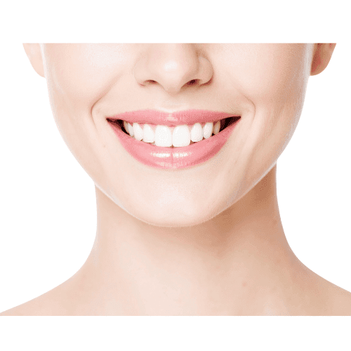 Hollywood Gülüşü